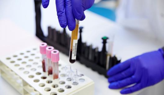 Glove hands handling blood samples in haematology laboratory